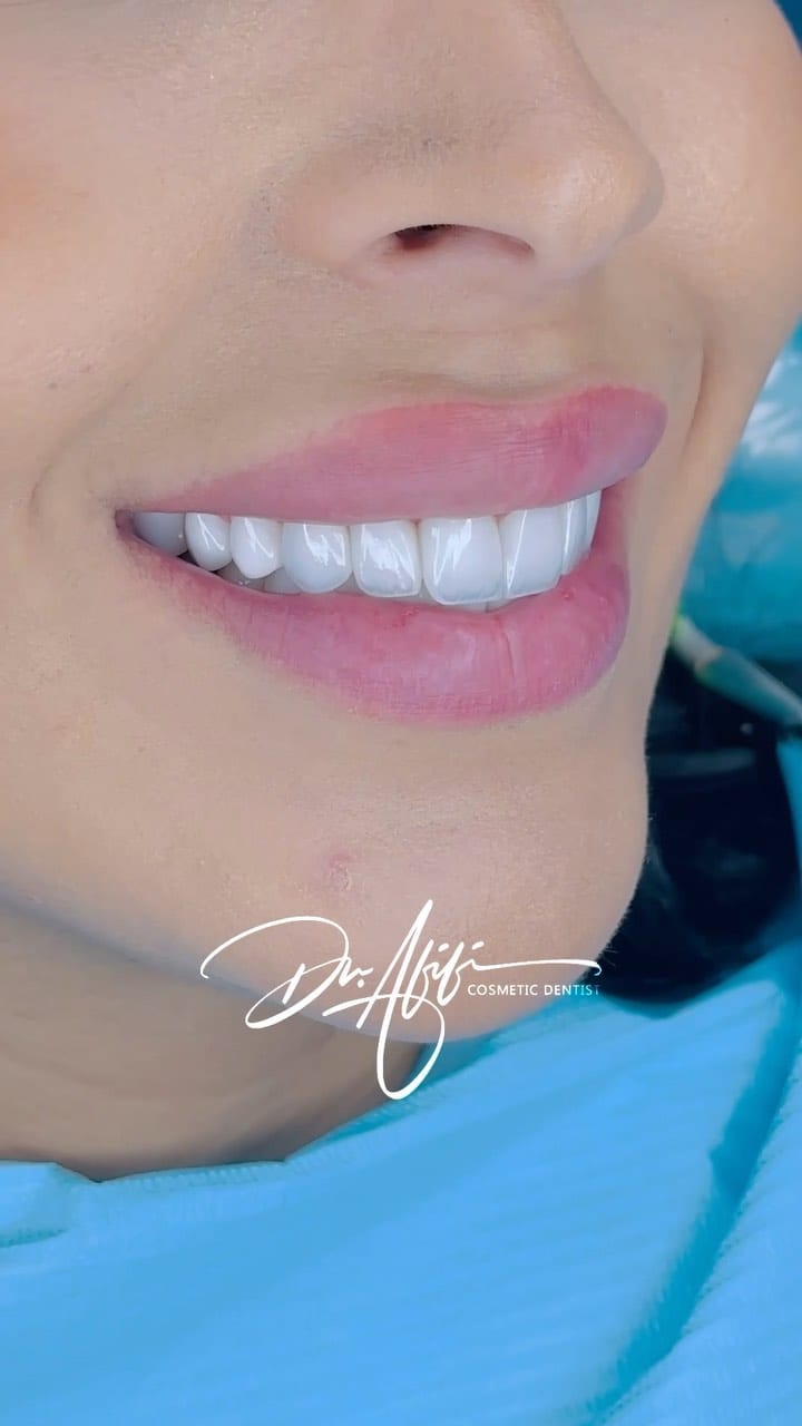 Post 10 by Dr.Mohamed Afifi | Cosmetic Dentist | DUBAI on Instagram (video)