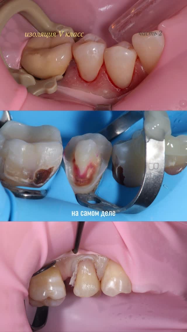 Post 3 by Ирина Калинина • стоматолог • обучение on Instagram (video)