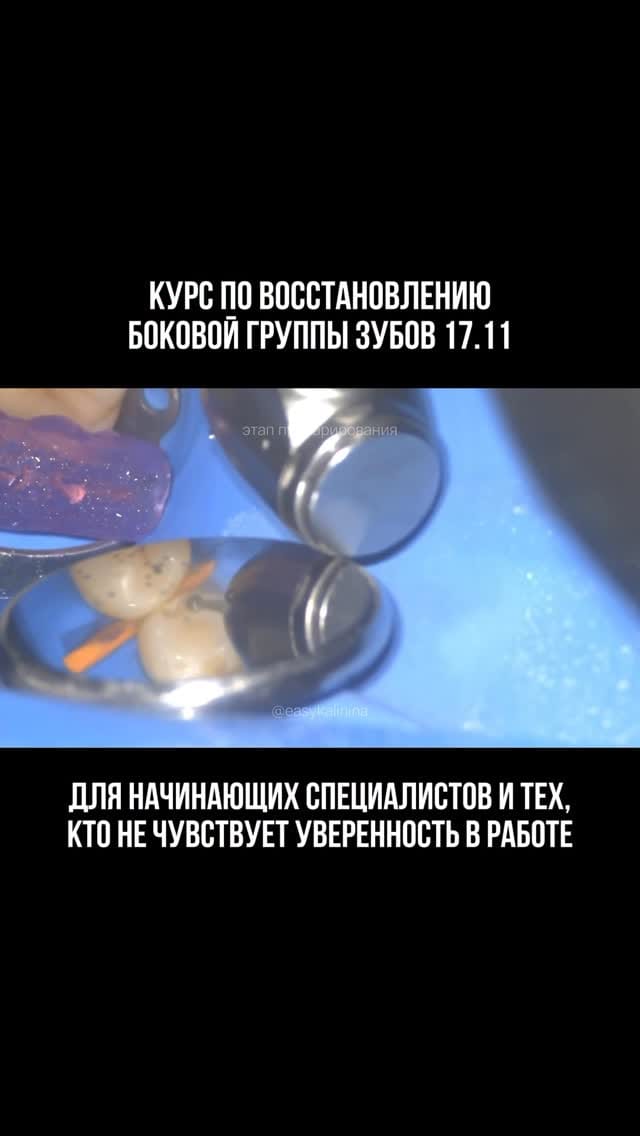 Post 5 by Ирина Калинина • стоматолог • обучение on Instagram (video)