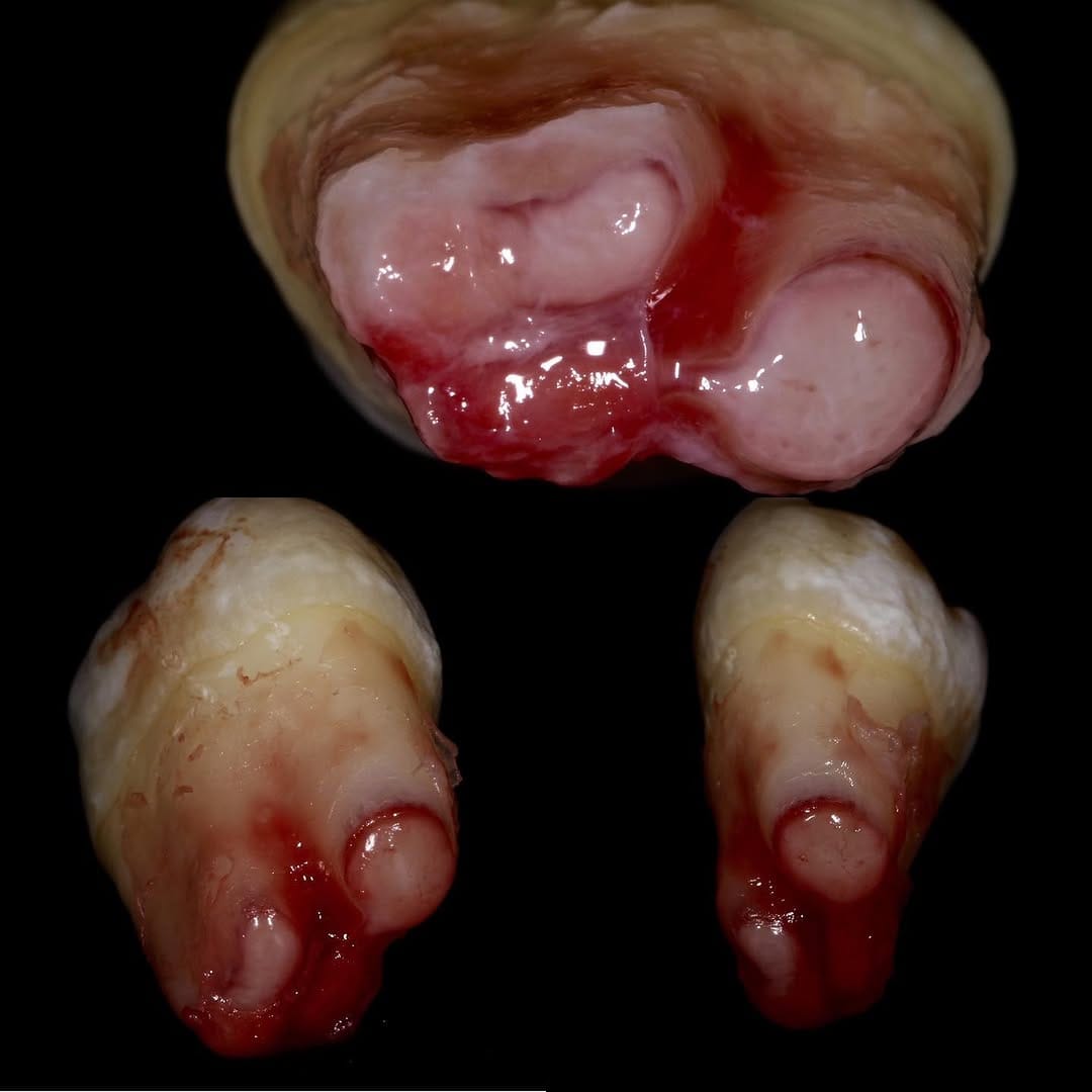 Post 4 by Oralsurgeries on Instagram (image)