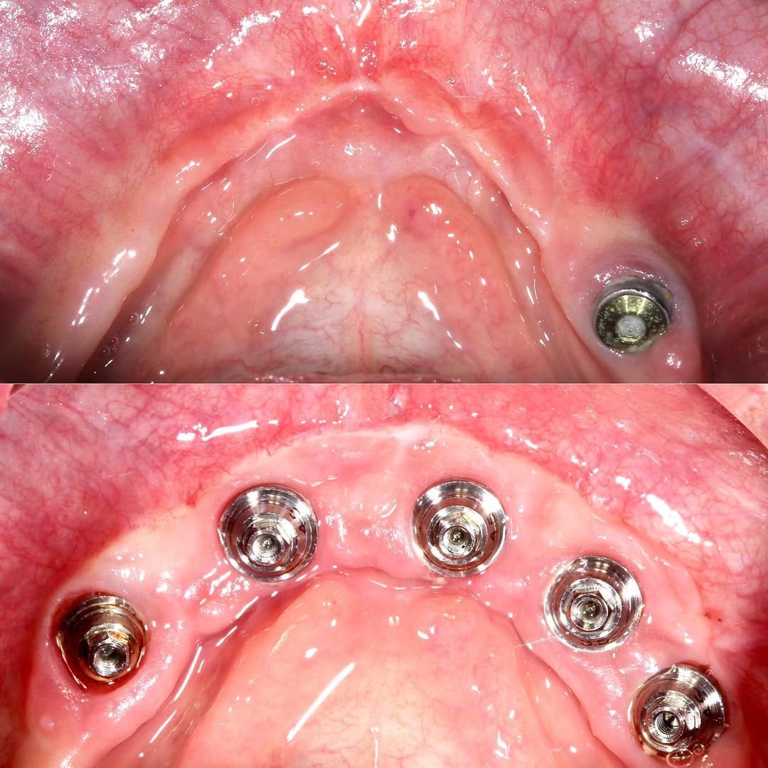 Post 1 by Oralsurgeries on Instagram (image)