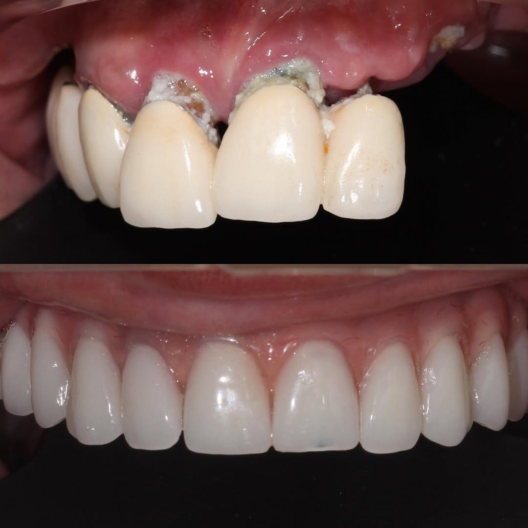 Post 7 by Oralsurgeries on Instagram (carousel)