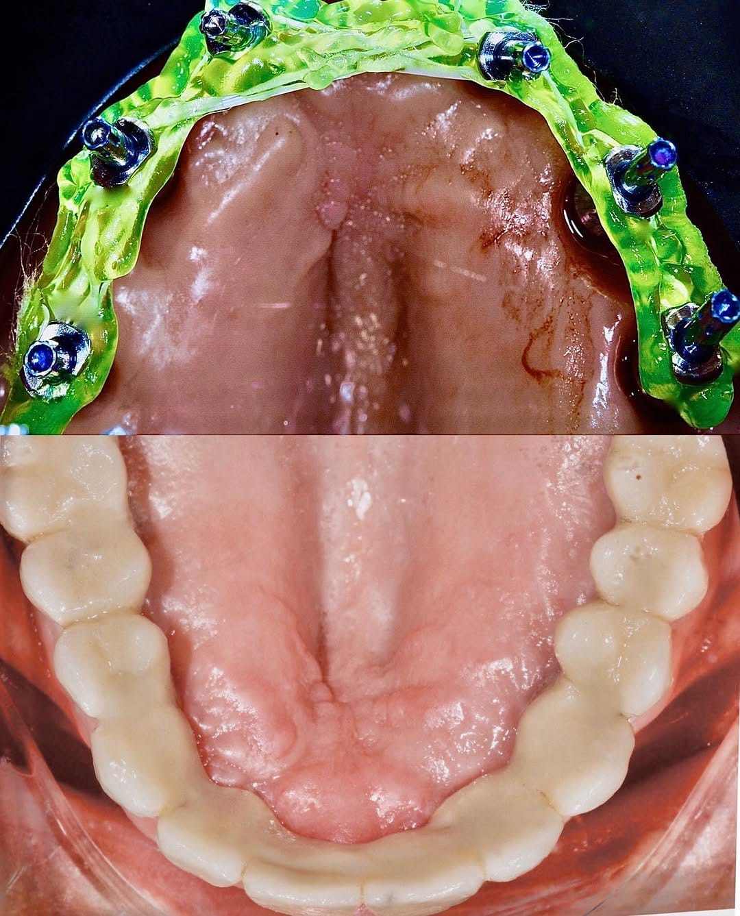 Post 10 by Oralsurgeries on Instagram (image)