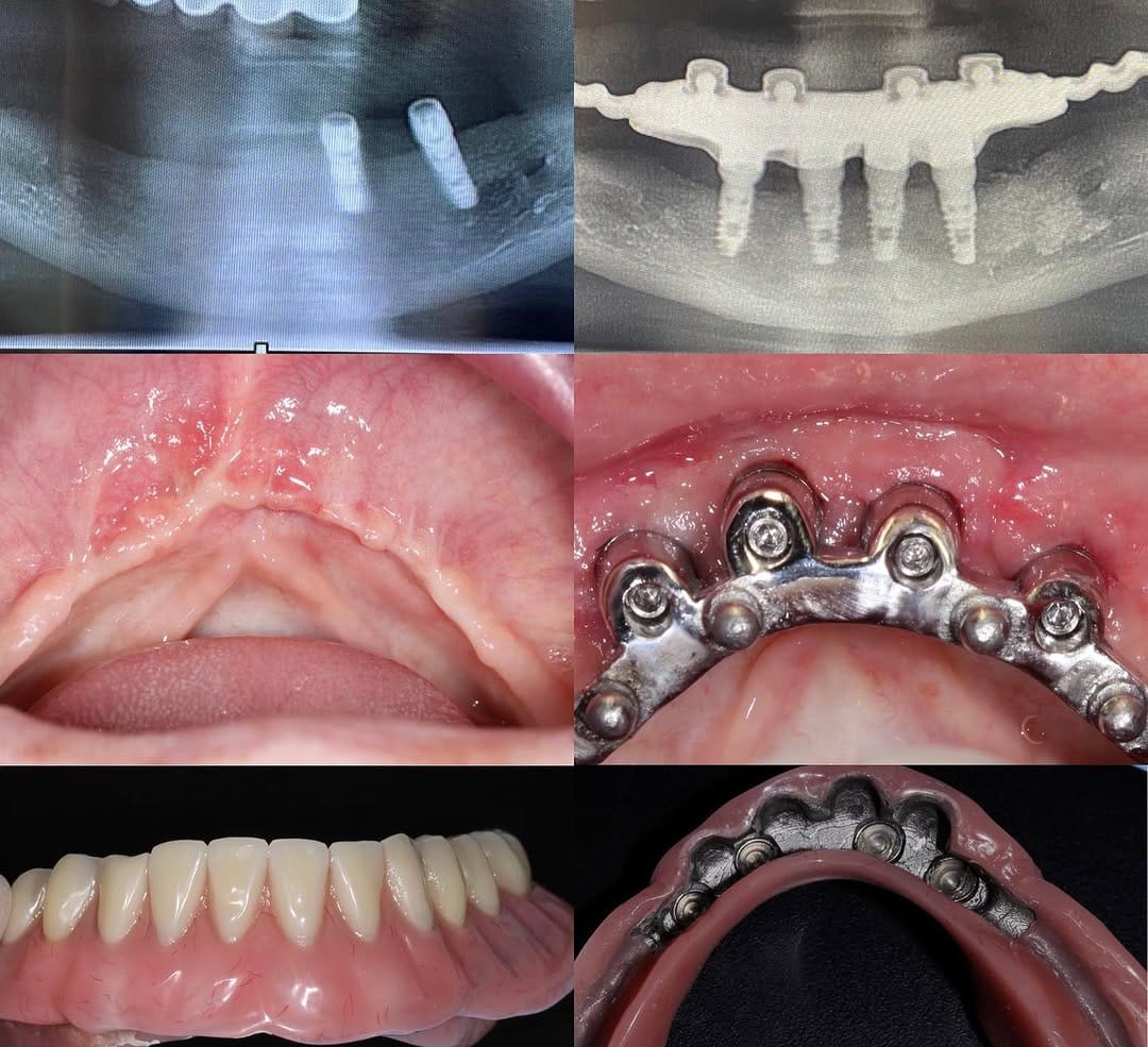 Post 2 by Oralsurgeries on Instagram (carousel)