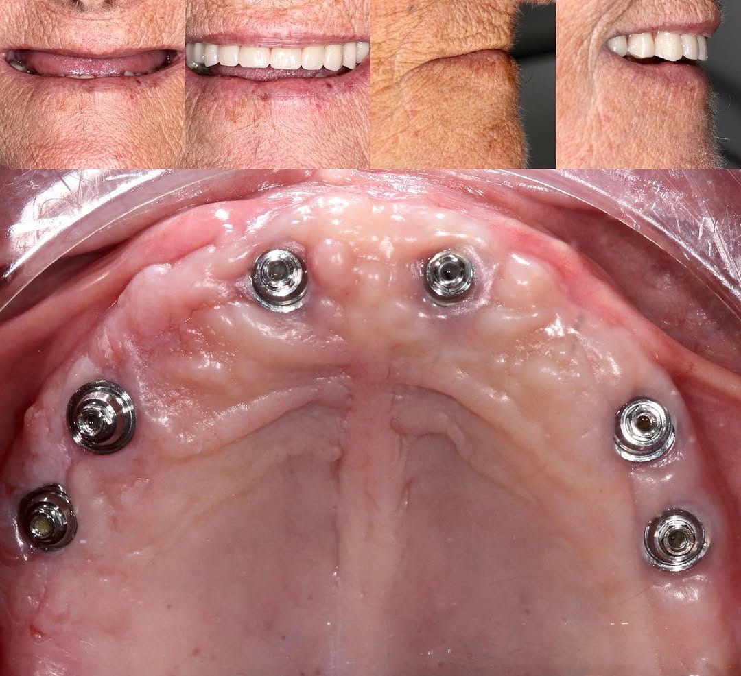 Post 3 by Oralsurgeries on Instagram (image)