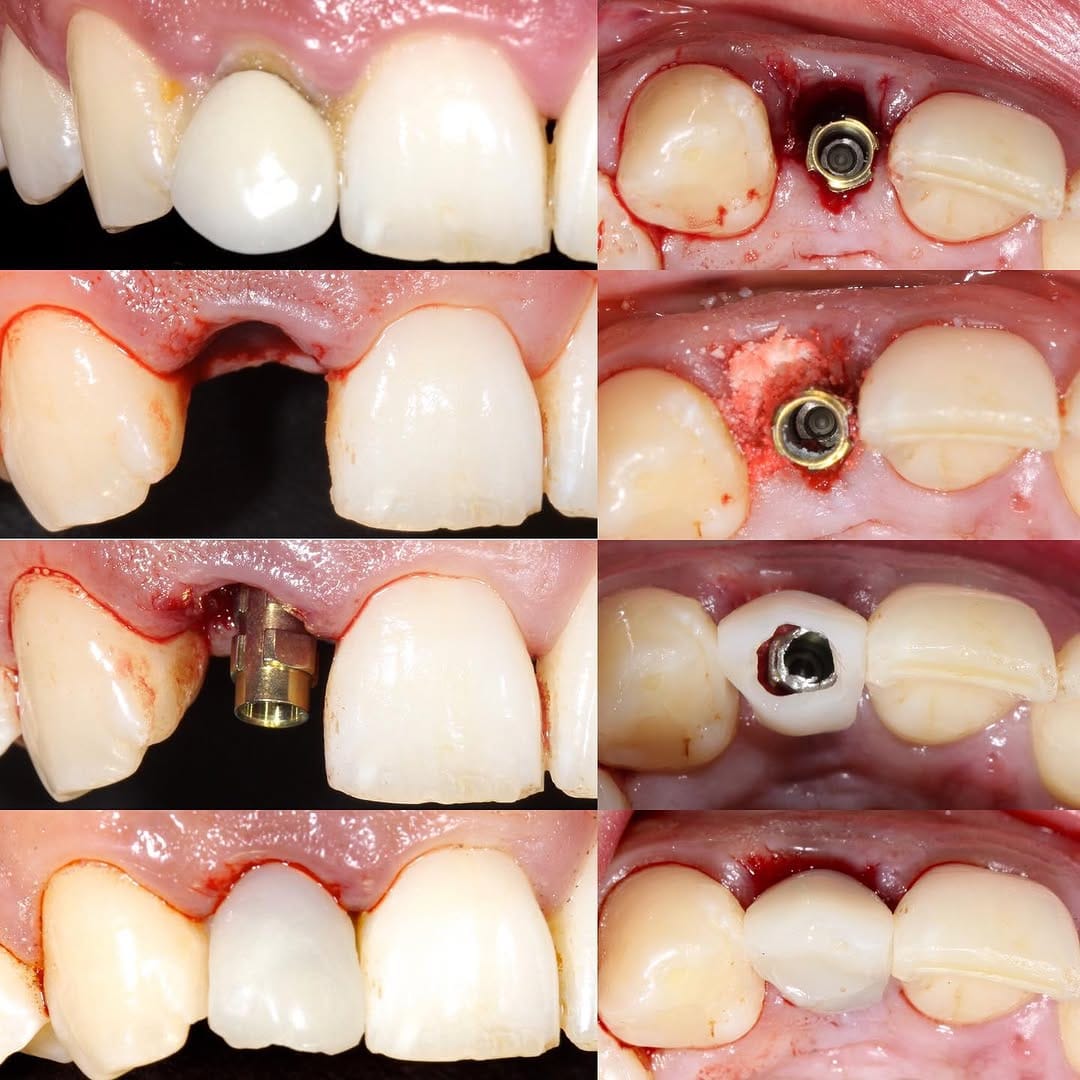Post 9 by Oralsurgeries on Instagram (image)