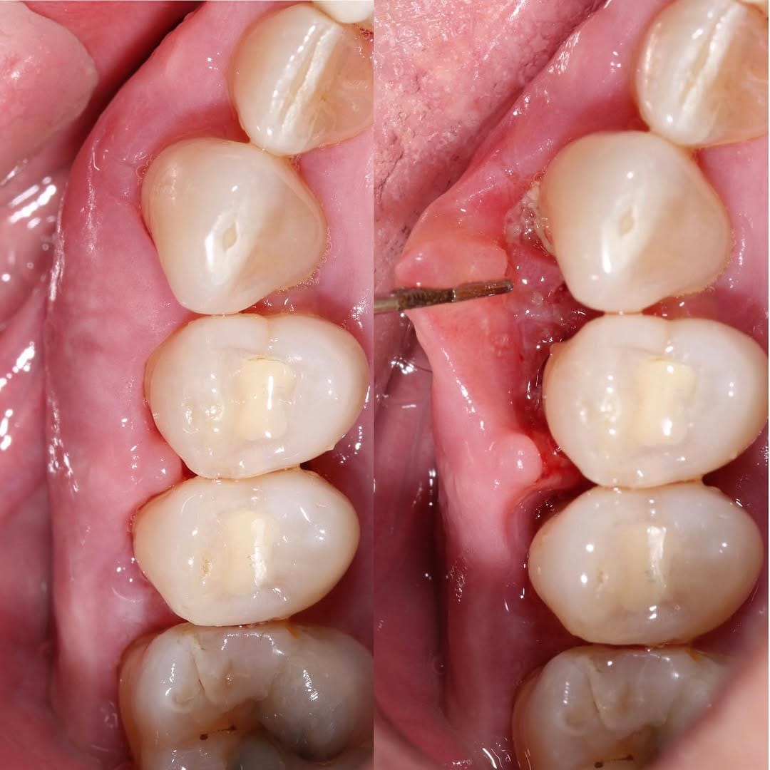 Post 5 by Oralsurgeries on Instagram (carousel)