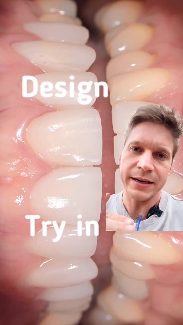 Post 3 by Jake Bateman FAGD | Nashville Aesthetic Dentist on Instagram (video)