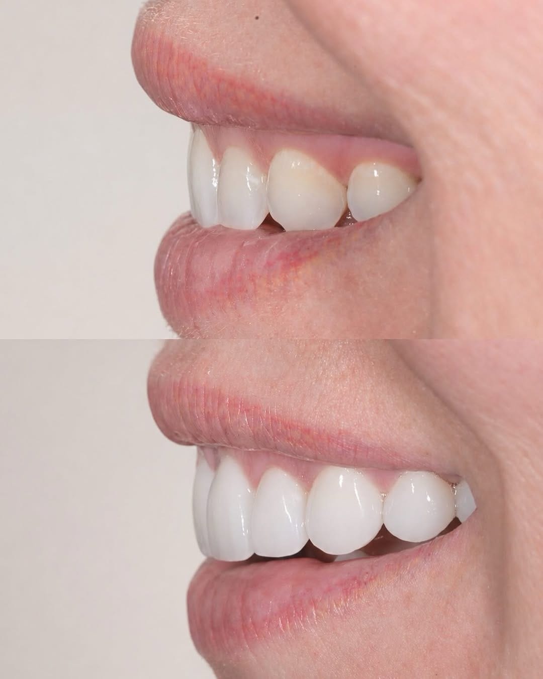 Post 4 by Jake Bateman FAGD | Nashville Aesthetic Dentist on Instagram (image)