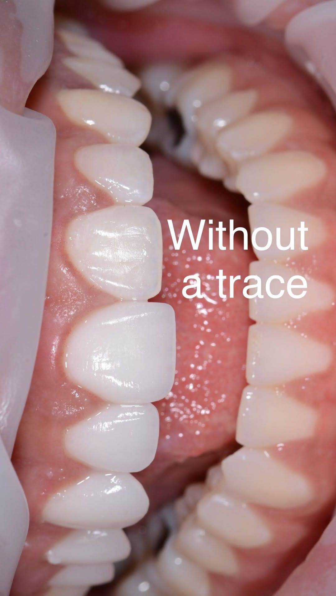 Post 9 by Jake Bateman FAGD | Nashville Aesthetic Dentist on Instagram (video)
