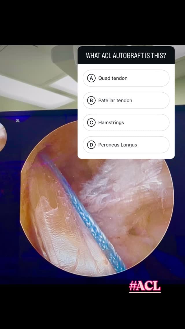 Post 8 by Dr. Travis Menge, MD on Instagram (video)