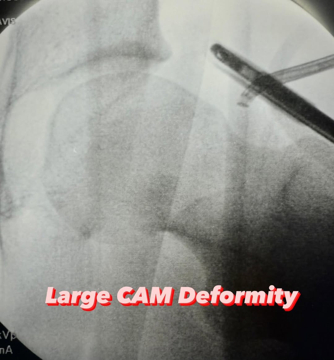 Post 10 by Dr. Travis Menge, MD on Instagram (carousel)