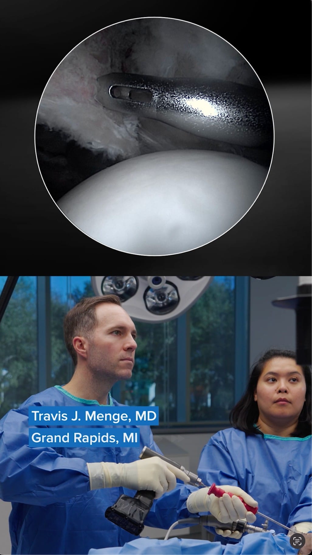 Post 1 by Dr. Travis Menge, MD on Instagram (video)