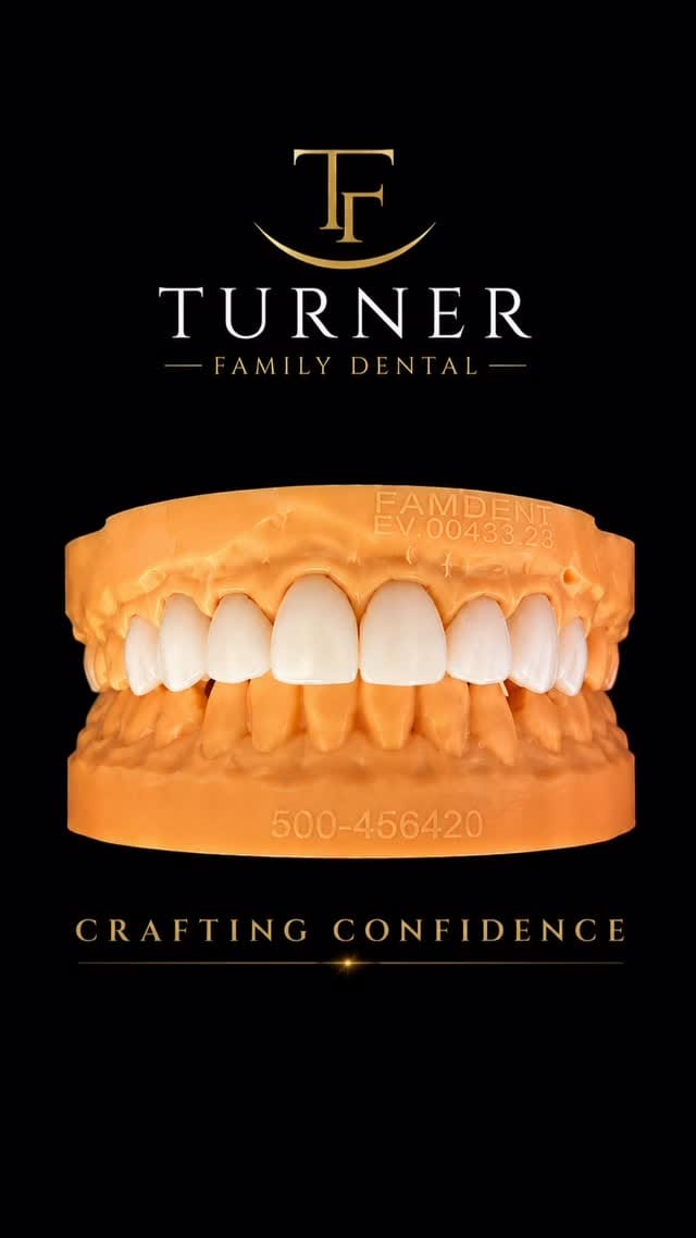 Post 1 by Turner Family Dental on Instagram (video)