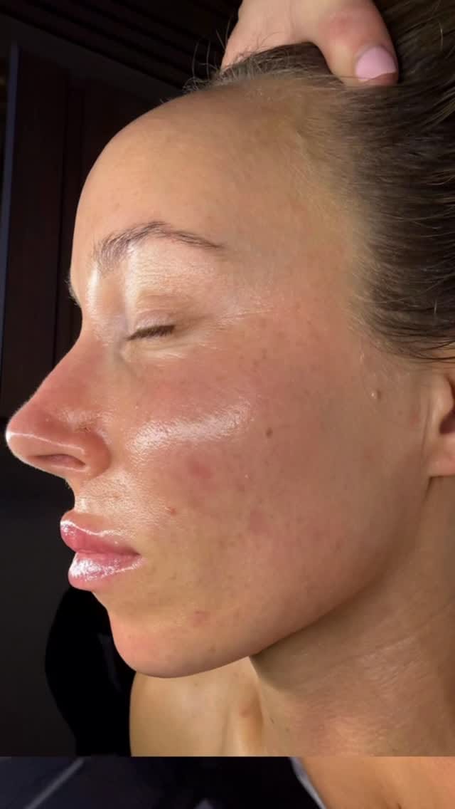 Post 10 by San Diego Estheticians on Instagram (video)