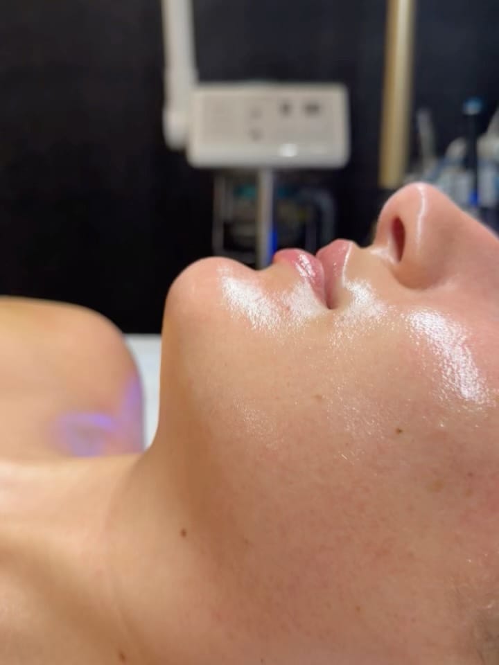 Post 1 by San Diego Estheticians on Instagram (carousel)