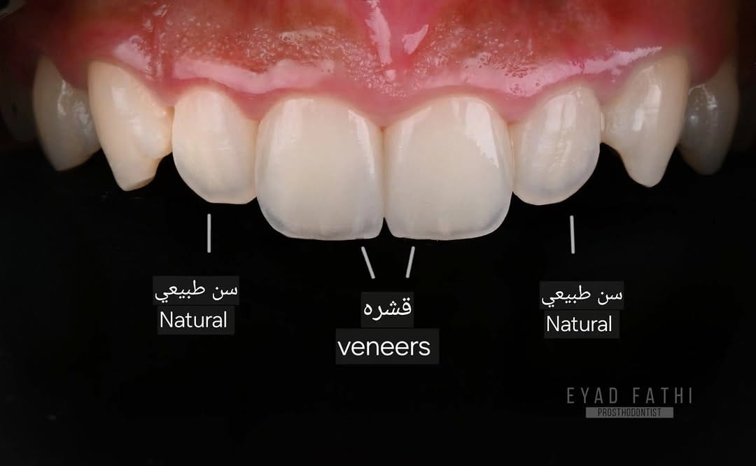 Post 8 by Dr. EYAD FATHI | د. إياد فتحي on Instagram (image)