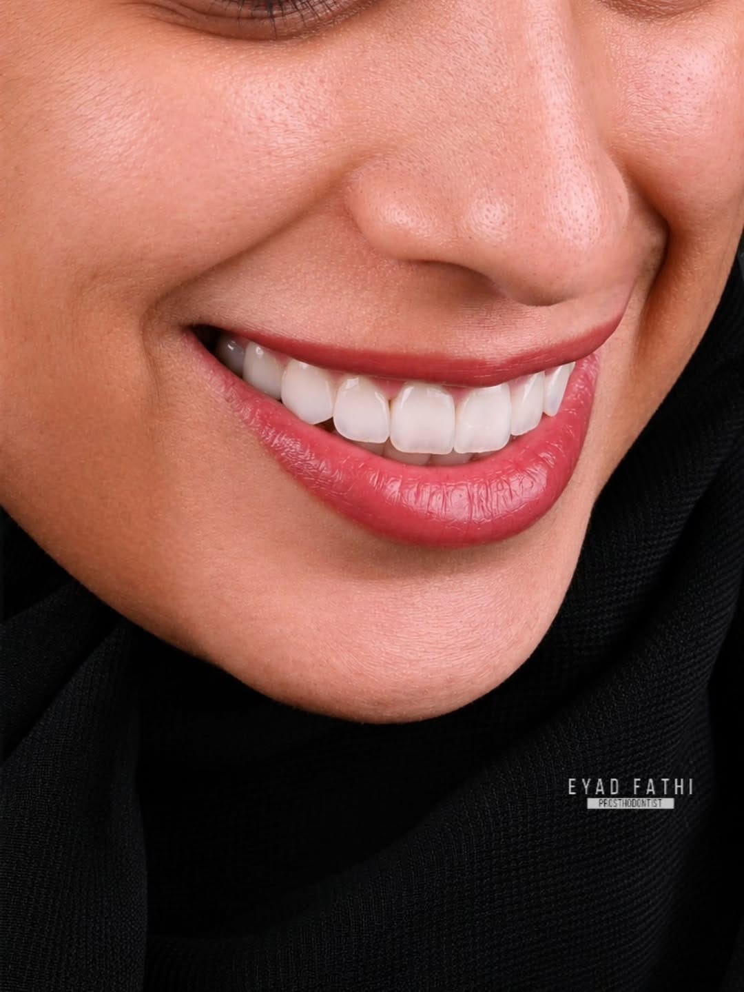Post 2 by Dr. EYAD FATHI | د. إياد فتحي on Instagram (carousel)