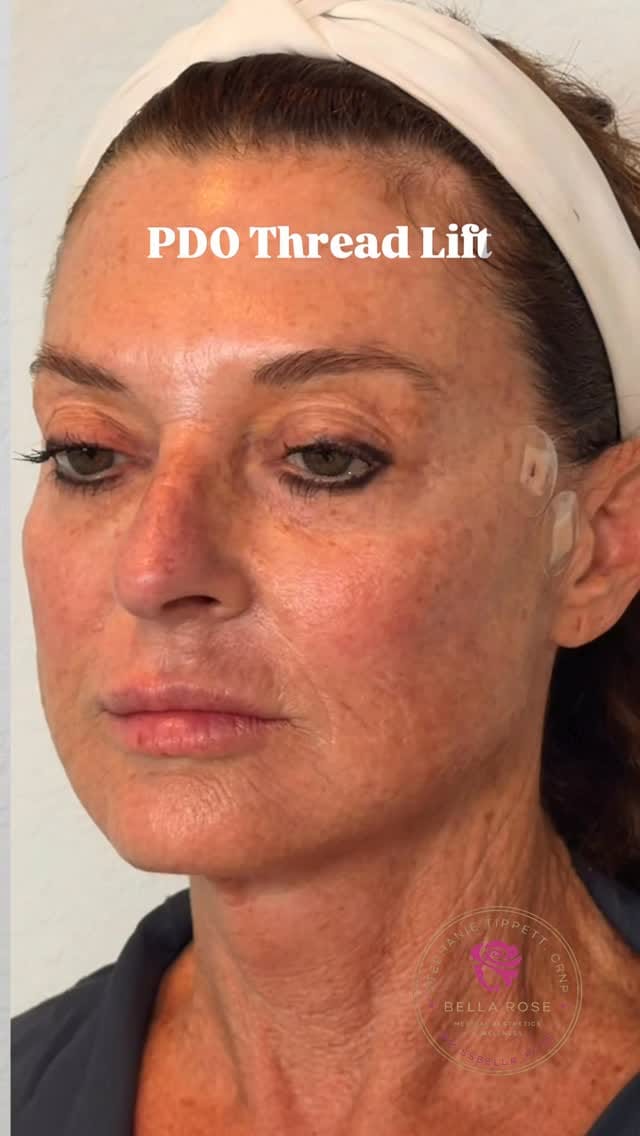 Post 4 by Stephanie Rose Tippett, MSN, CRNP⚕️, FNP-C 🩺, CANS 💉👄 on Instagram (video)