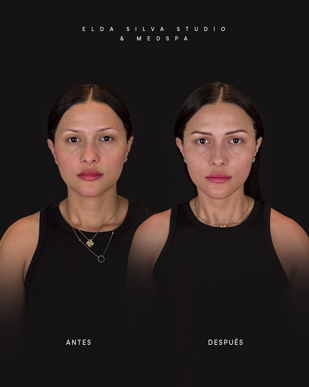 Post 8 by Elda Silva Studio & Medspa on Instagram (carousel)
