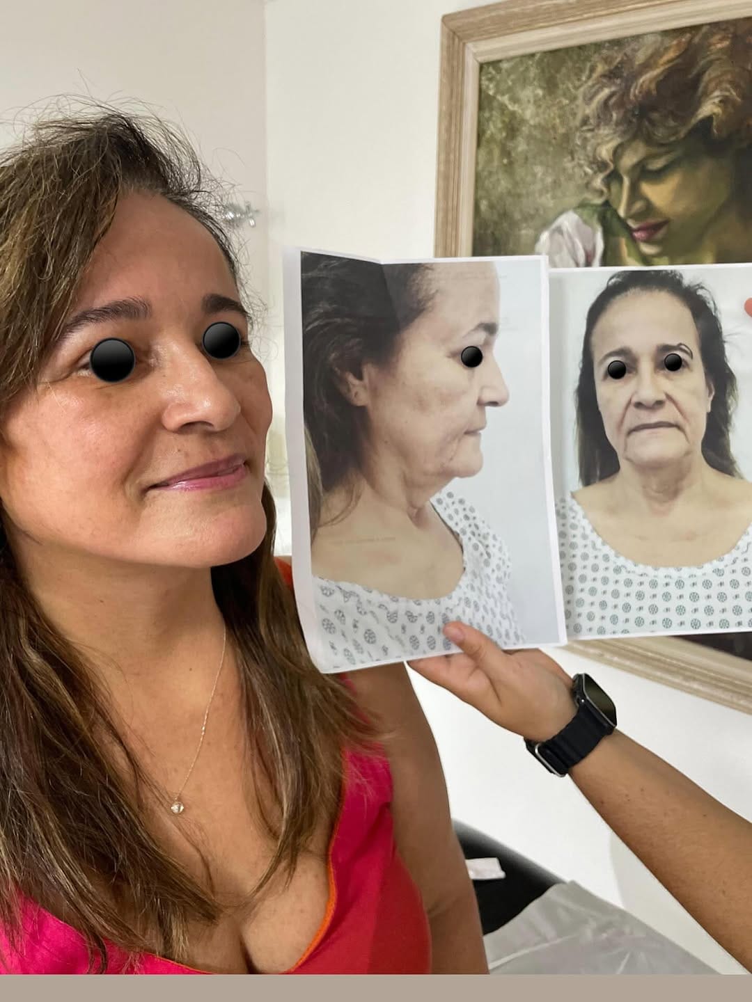 Post 9 by Rômulo Romano  - Cirurgião Plástico on Instagram (image)