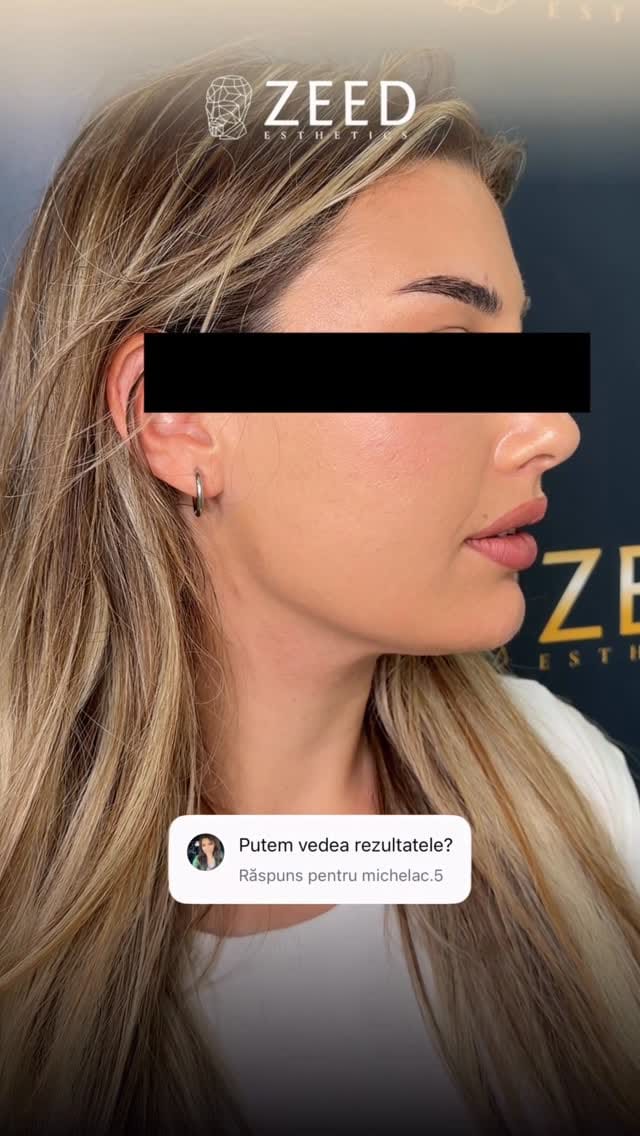 Post 7 by Dr.MohamadZeed/Plastic Surgeon on Instagram (video)