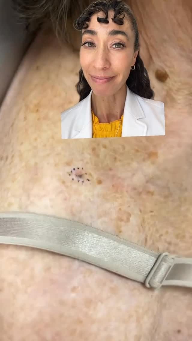 Post 8 by Sage Dermatology & Mohs Surgery | Utah on Instagram (video)