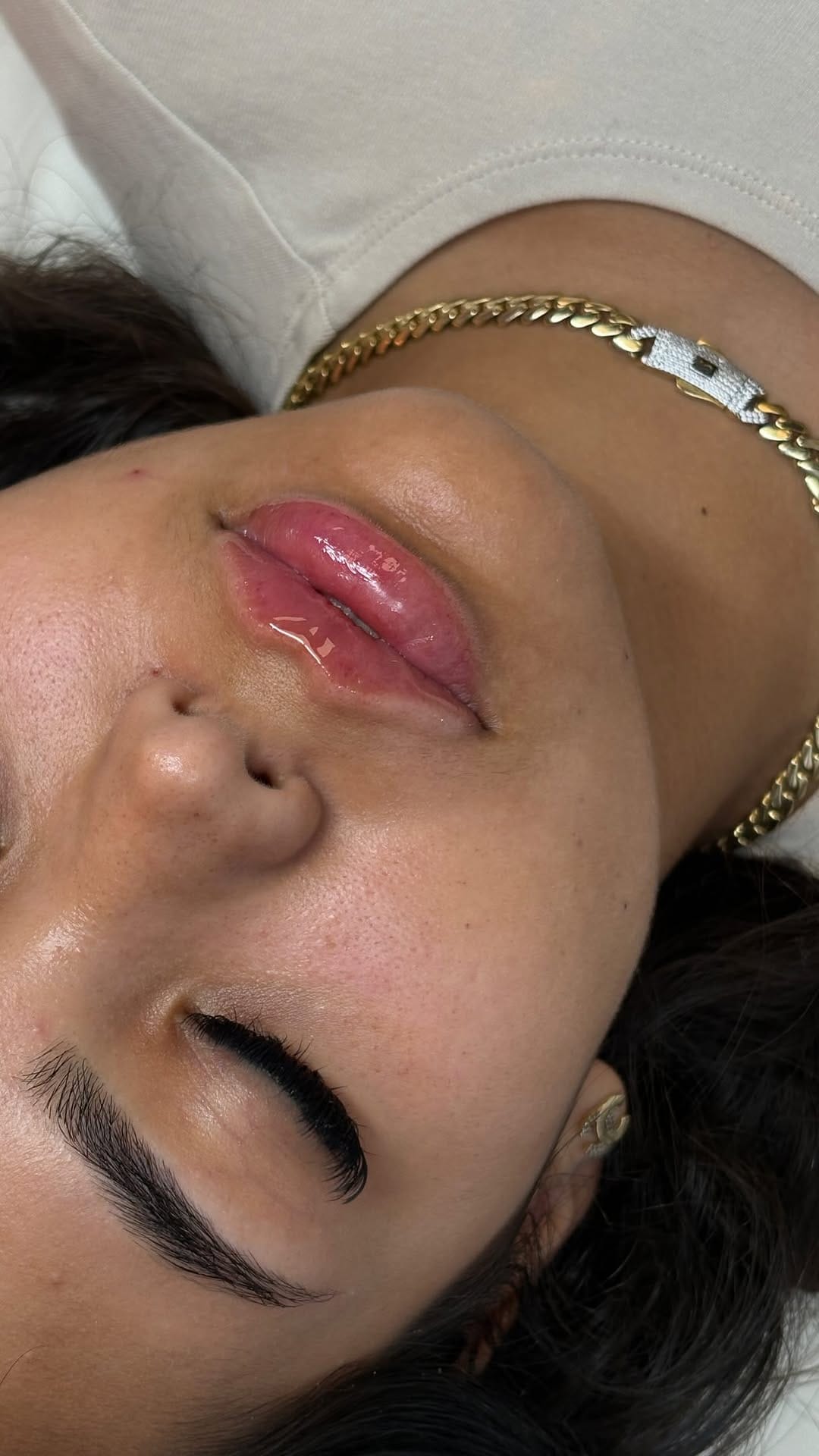 Post 6 by Body Glow Esthetics on Instagram (video)