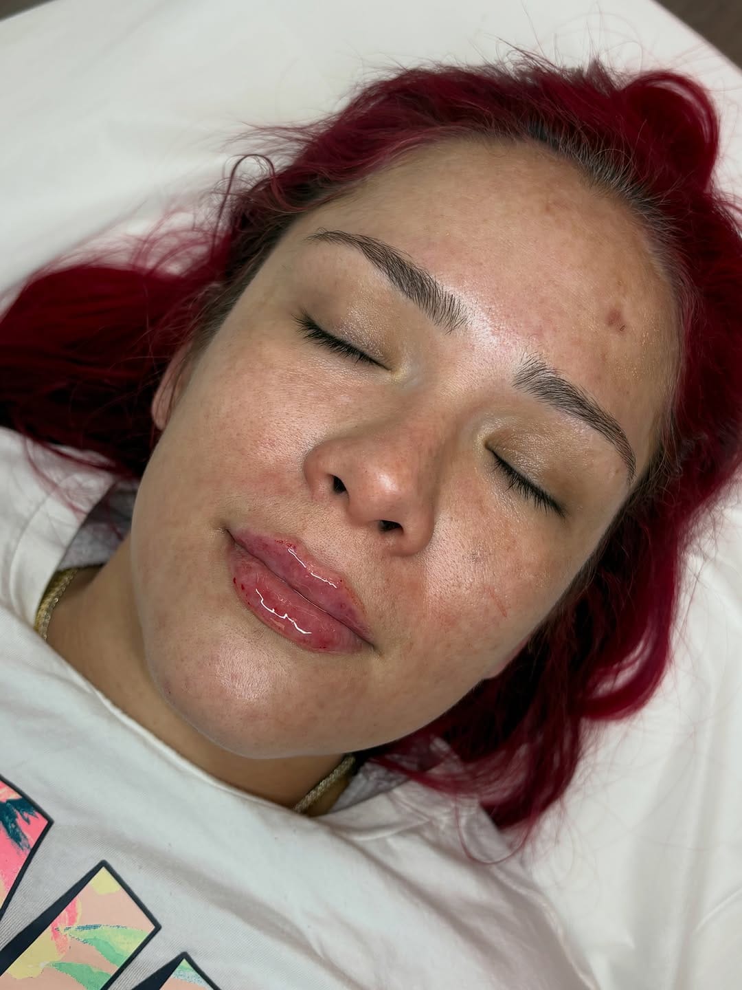 Post 5 by Body Glow Esthetics on Instagram (carousel)