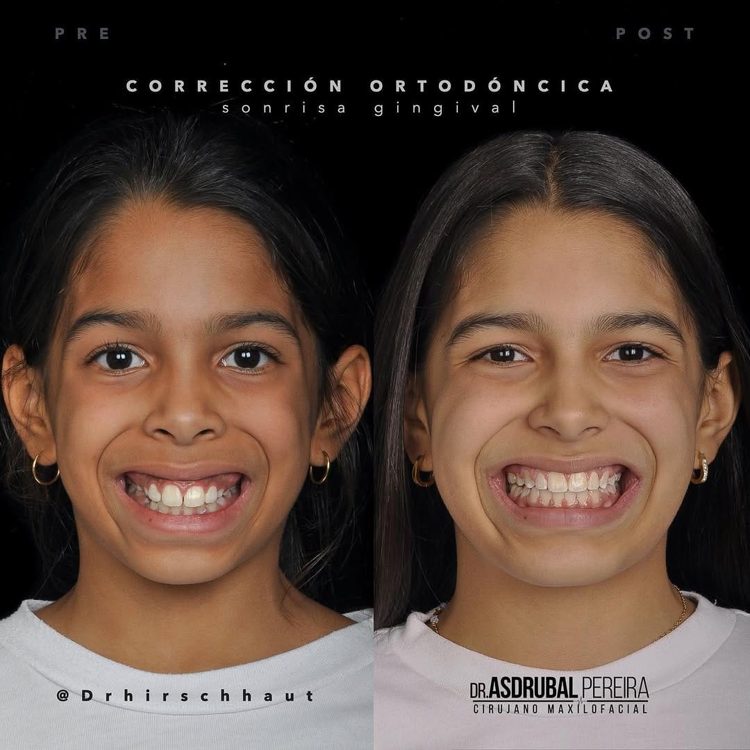 Post 9 by Asdrubal Pereira on Instagram (carousel)