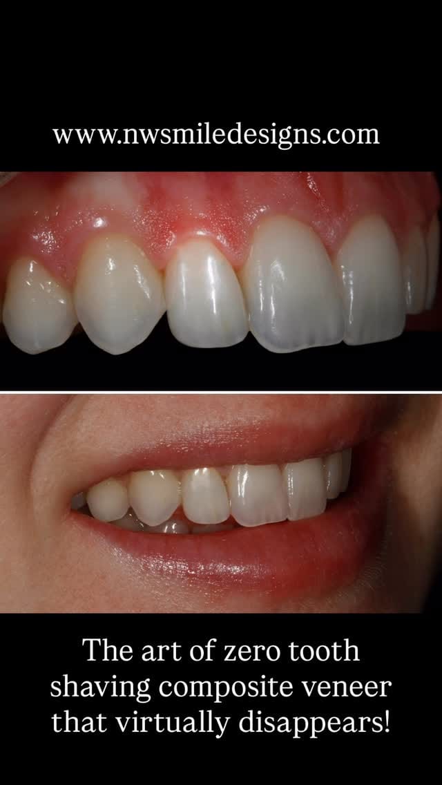 Post 3 by Dr. David K. Chan, DMD, AAACD on Instagram (video)