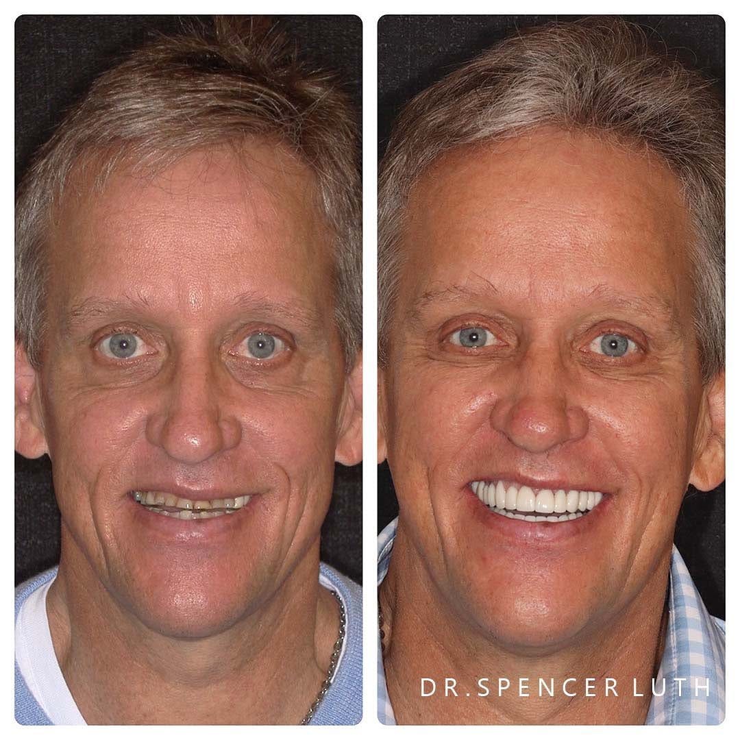 Post 1 by Las Vegas Cosmetic Dentist on Instagram (carousel)