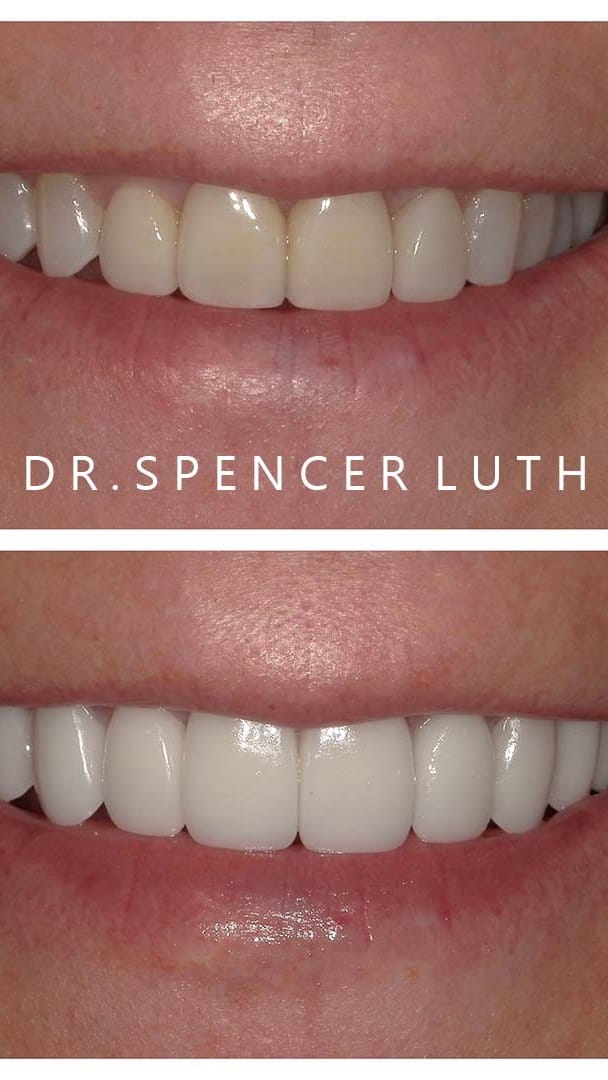 Post 2 by Las Vegas Cosmetic Dentist on Instagram (video)