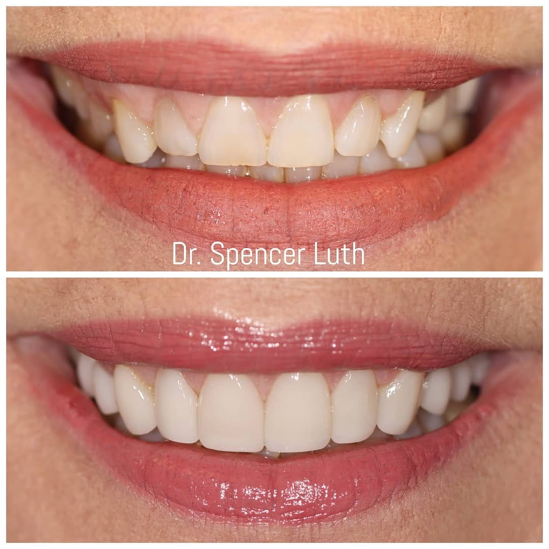 Post 4 by Las Vegas Cosmetic Dentist on Instagram (image)