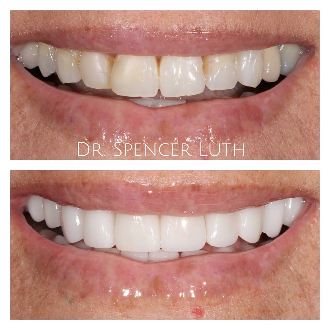 Post 7 by Las Vegas Cosmetic Dentist on Instagram (image)