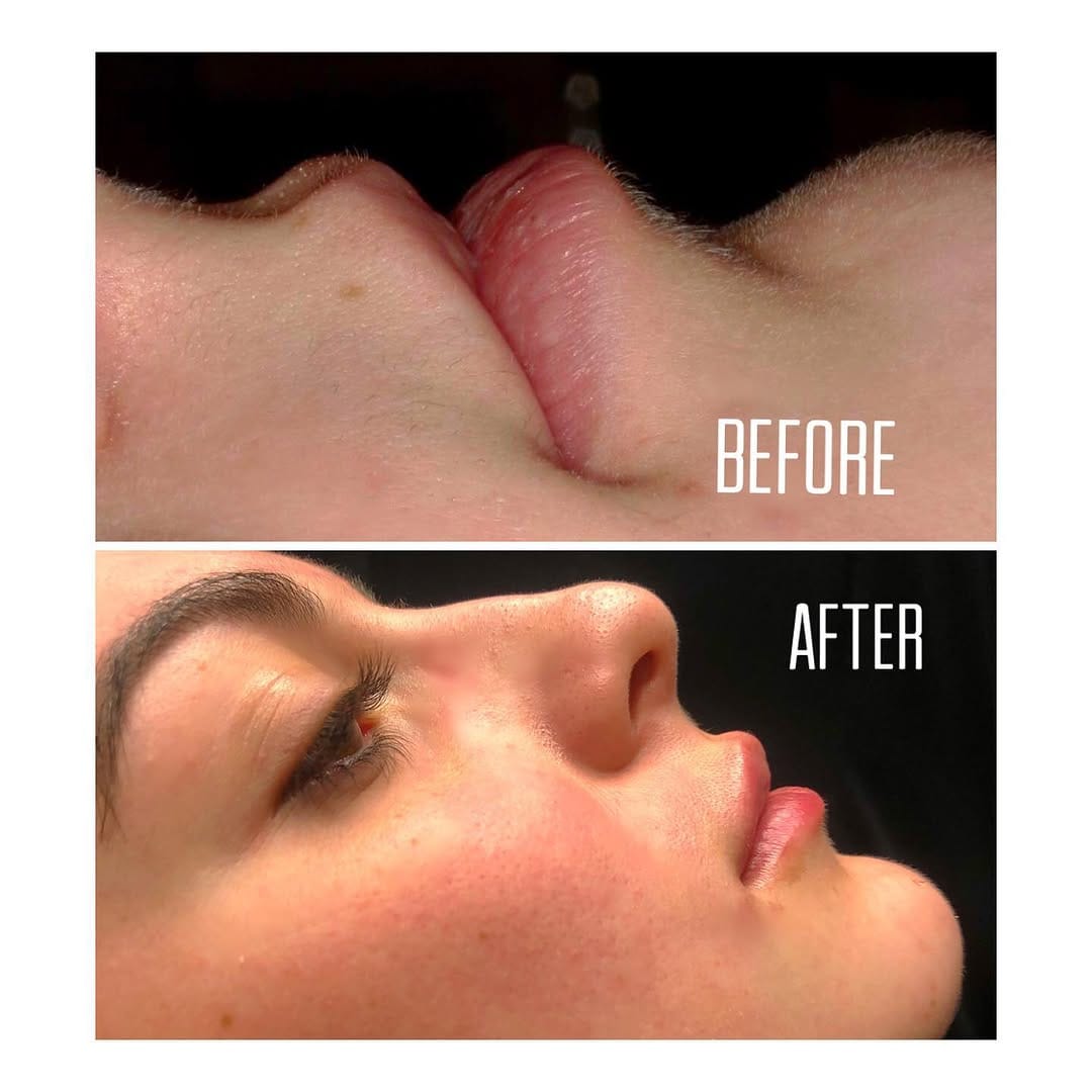 Post 5 by Las Vegas Cosmetic Dentist on Instagram (image)