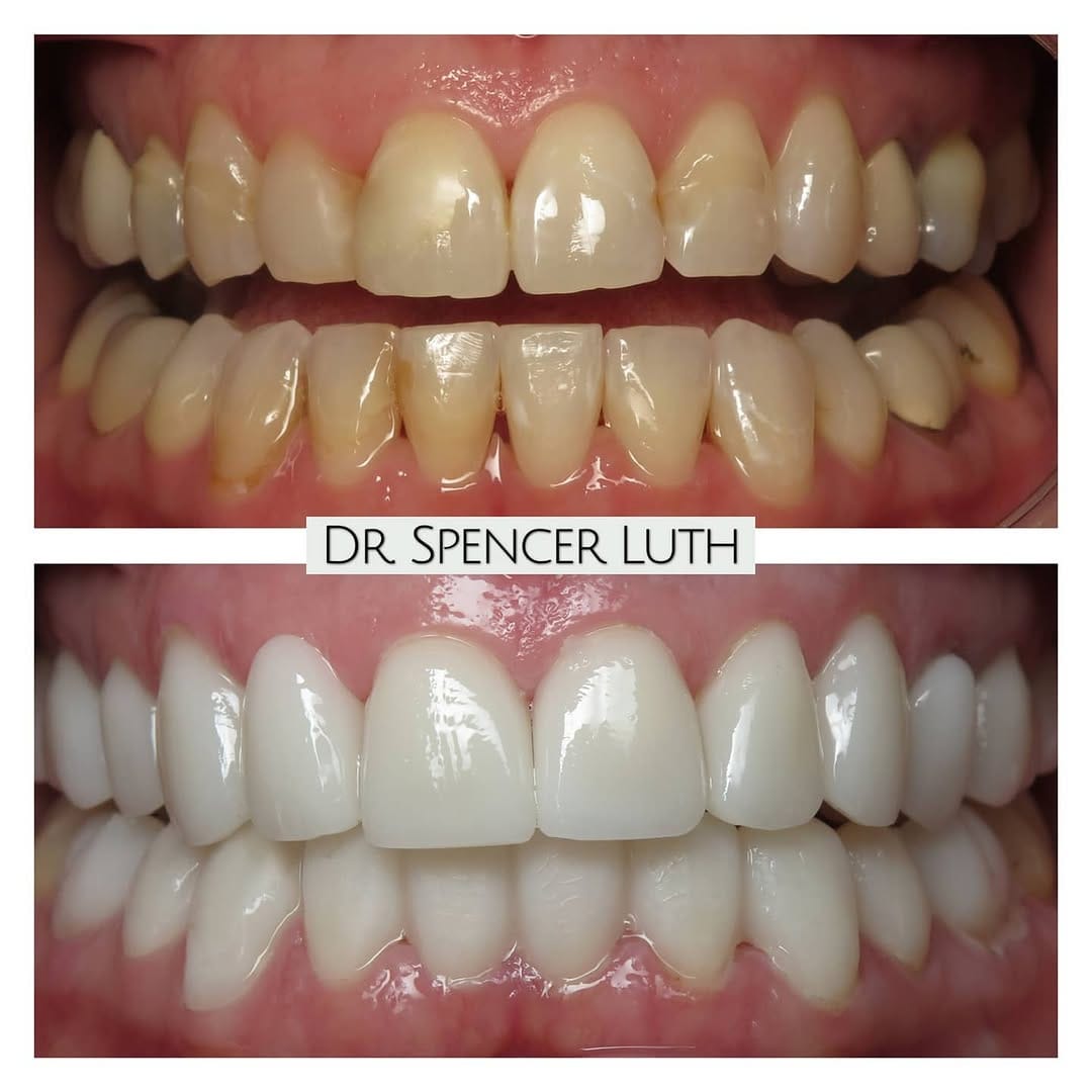 Post 9 by Las Vegas Cosmetic Dentist on Instagram (image)
