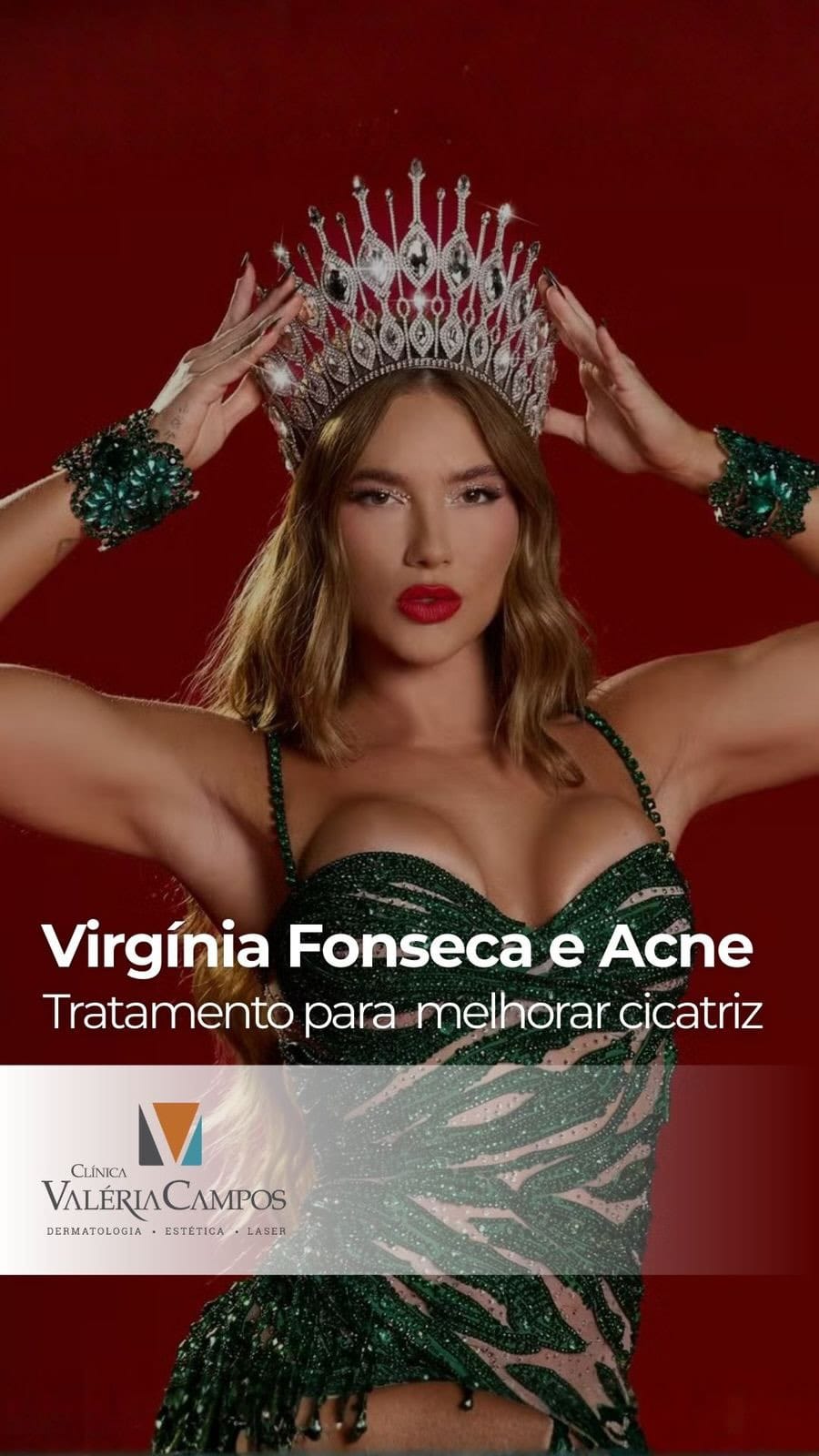 Post 10 by Valeria Barreto  Campos on Instagram (video)