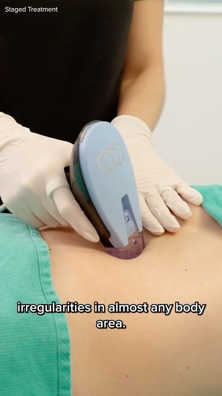 Post 10 by Dr. Andrés Sárraga on Instagram (video)