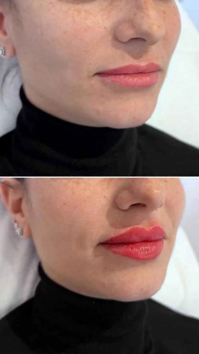 Post 3 by 𝑫r 𝑨𝒇𝒂𝒒 on Instagram (video)
