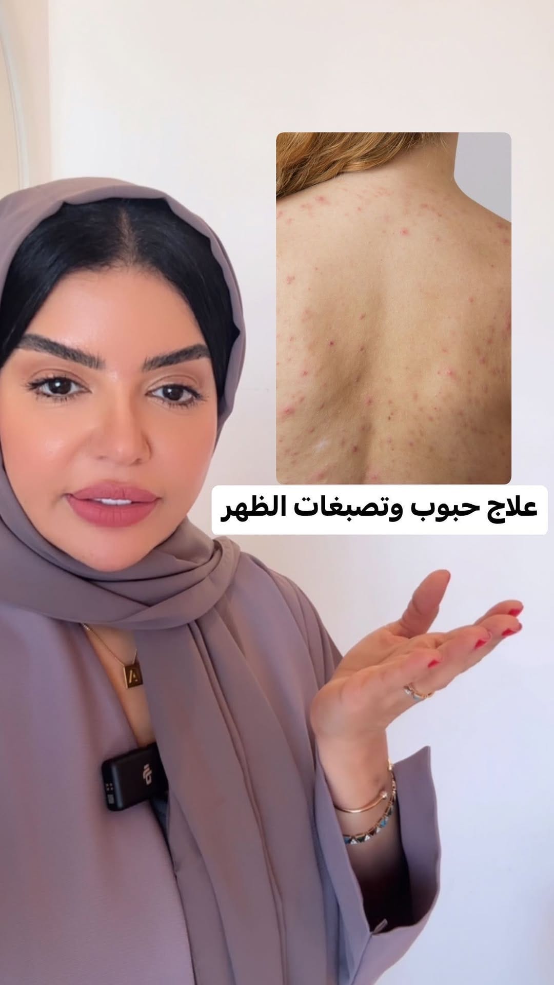 Post 9 by 𝑫r 𝑨𝒇𝒂𝒒 on Instagram (video)