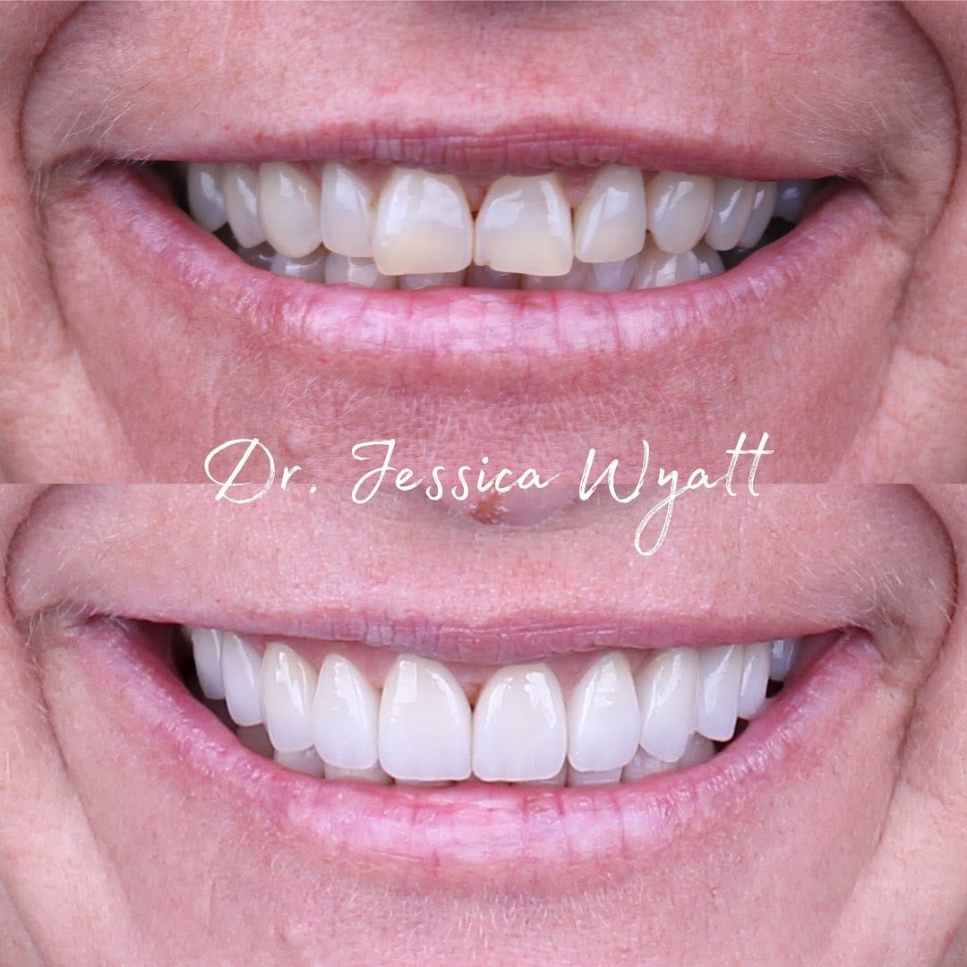 Post 9 by Jessica Wyatt on Instagram (image)
