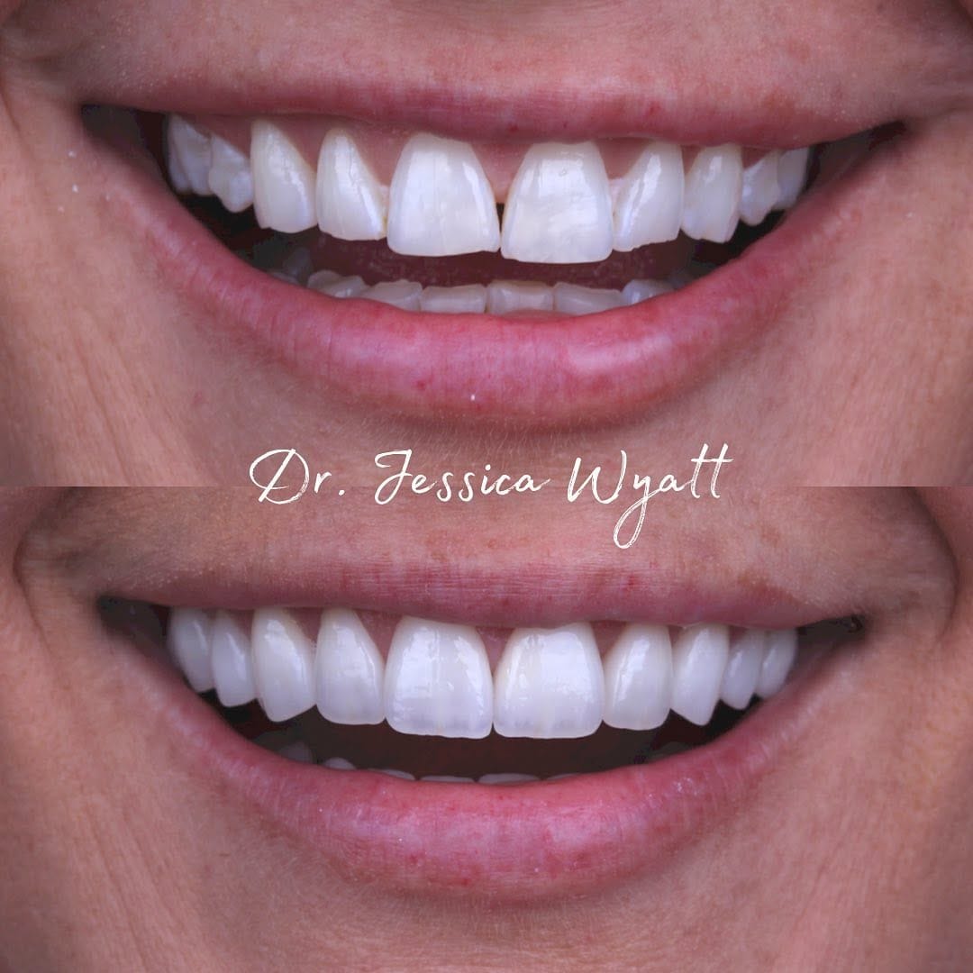 Post 10 by Jessica Wyatt on Instagram (image)