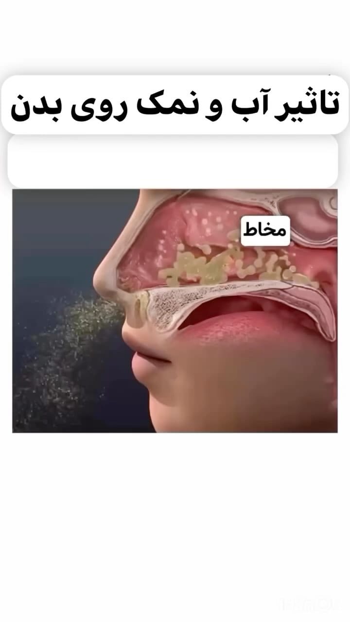 Post 10 by ﮼دکتر‌وهاب‌قنبری -متخصص‌ بیماریهای‌ نوزادان،‌ کودکان on Instagram (video)
