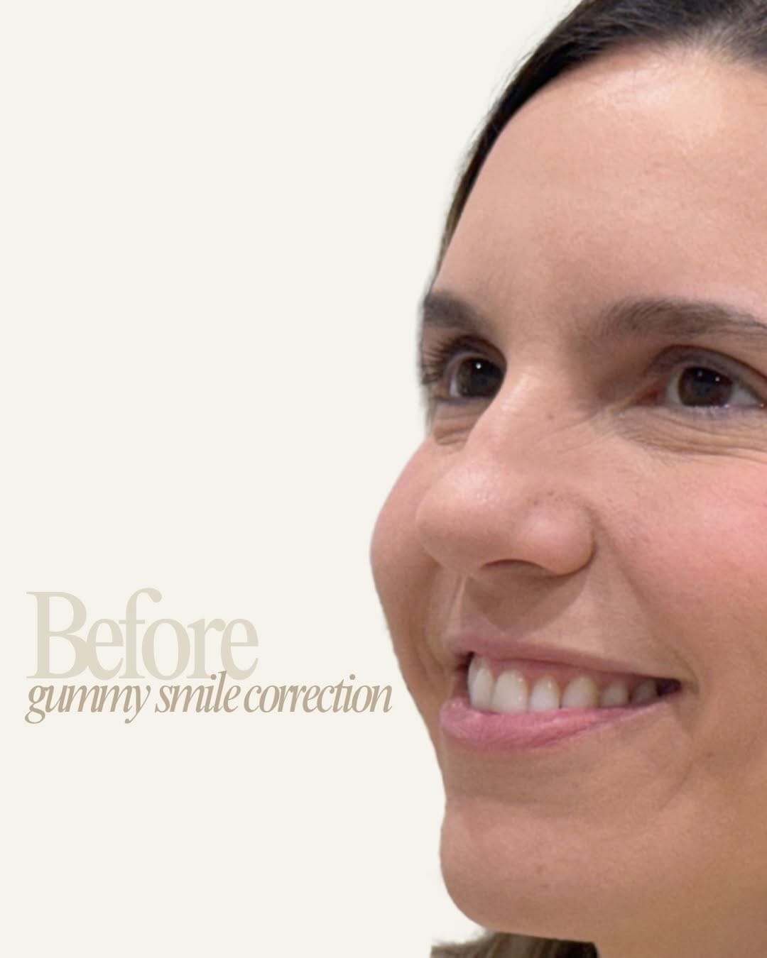 Post 1 by VIIV WELLNESS HAUS | MIAMI BEACH MED SPA on Instagram (carousel)