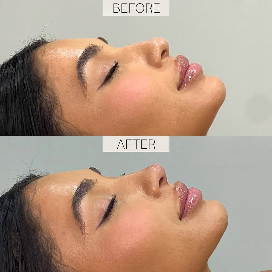 Post 10 by VIIV WELLNESS HAUS | MIAMI BEACH MED SPA on Instagram (carousel)