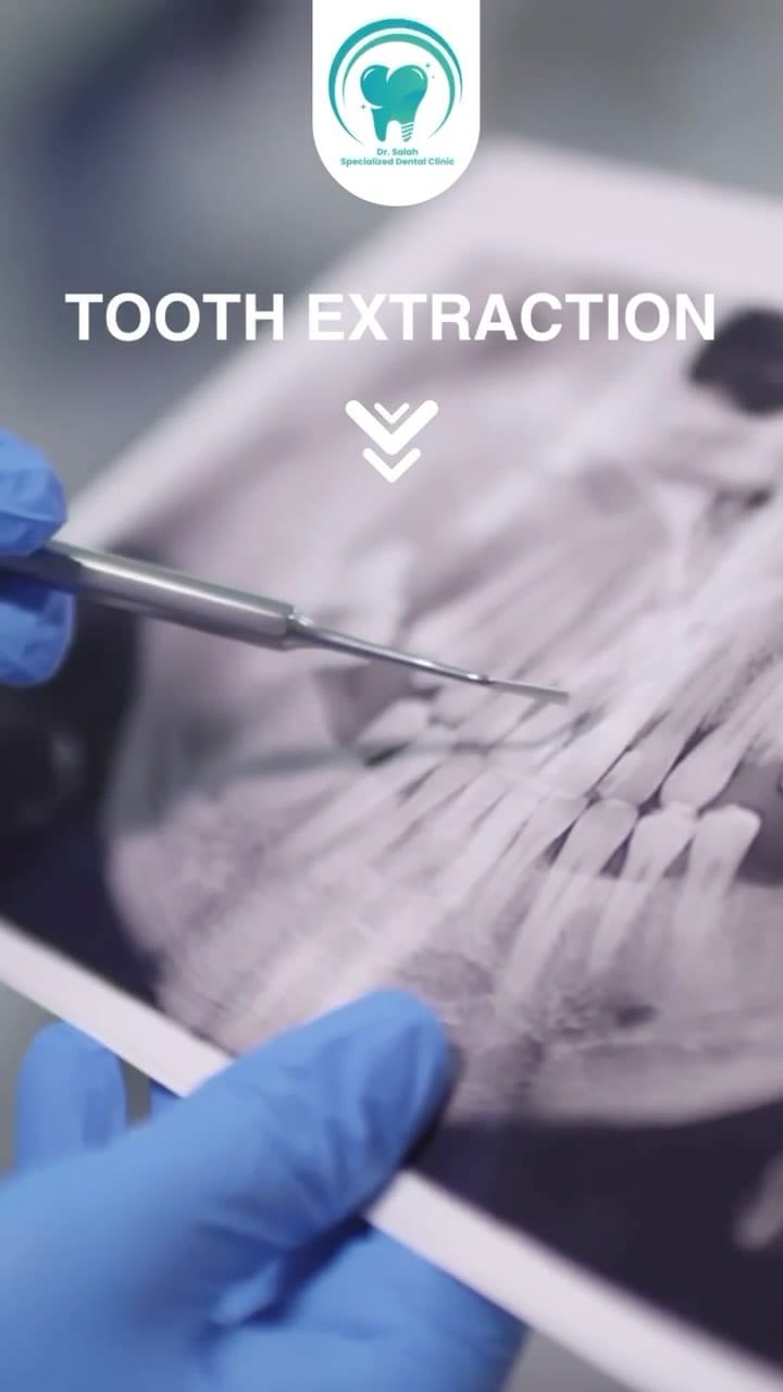 Post 4 by Dr.SalahRajab on Instagram (video)