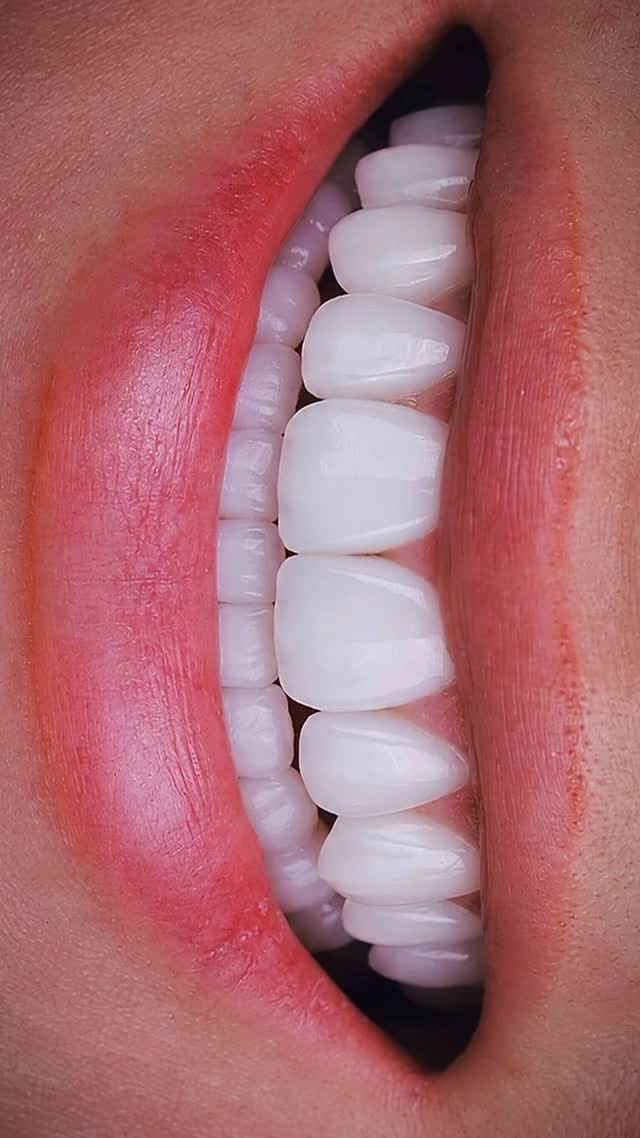 Post 5 by Sean Kutlay DDS on Instagram (video)