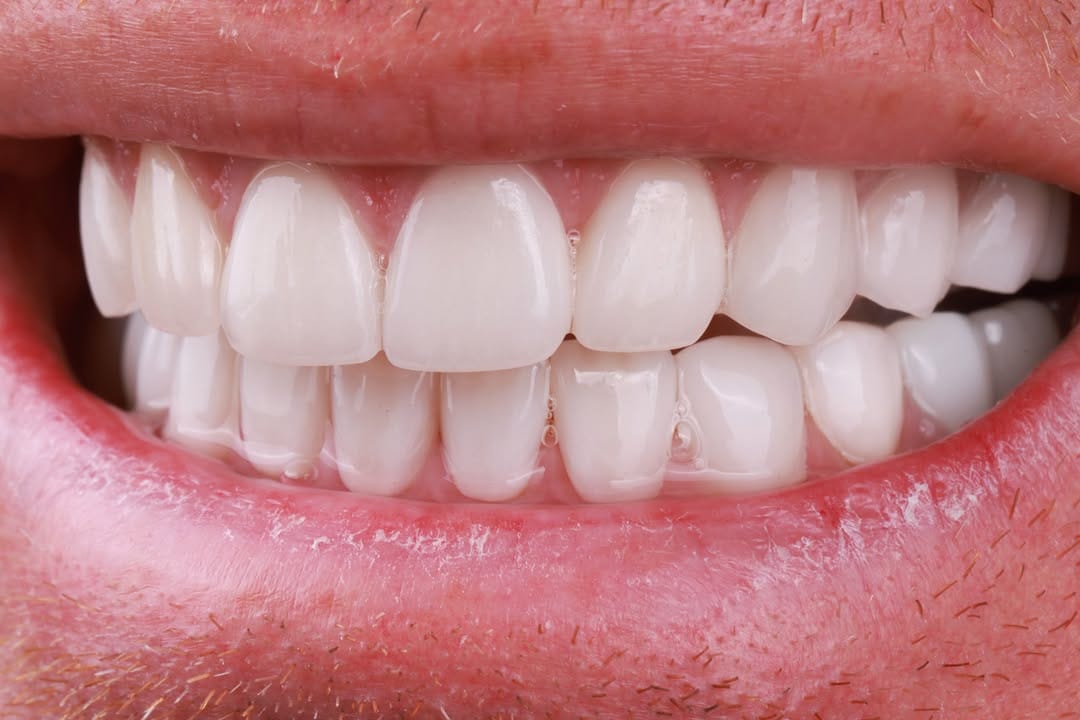Post 6 by Sean Kutlay DDS on Instagram (image)