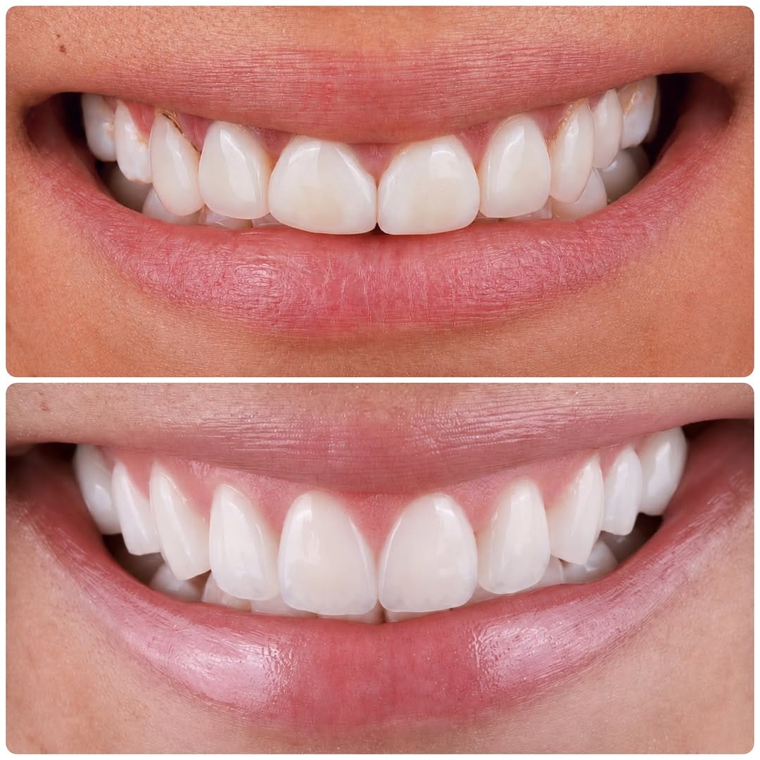 Post 2 by Sean Kutlay DDS on Instagram (image)